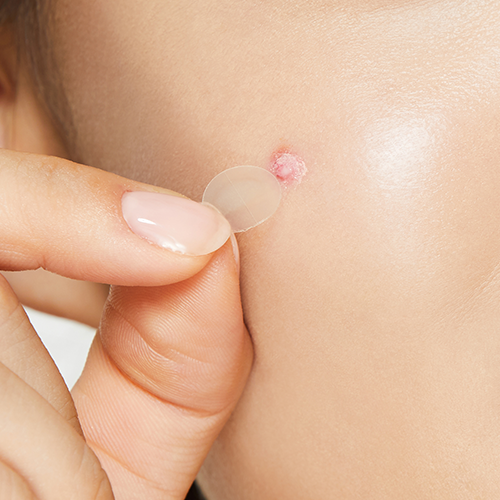 Clear Fit Master Patch