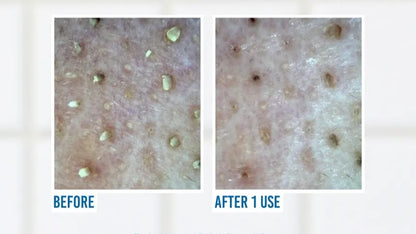 Jumiso Blackhead Melting Softener Special Set 150ml at Embé Skin Korean and Japanese Beauty Skincare