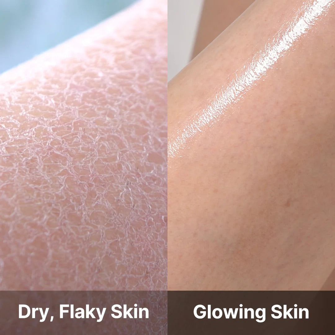 Medicube Red Acne Body Wash 2.0 400g at Embé Skin Korean and Japanese Beauty Skincare